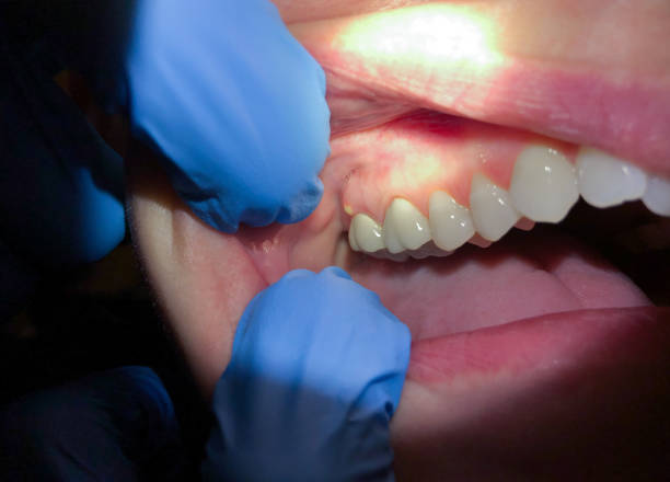 Best Broken Tooth Emergency  in Central Park, WA